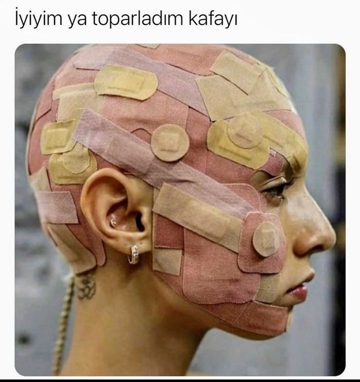 Gönderi görseli