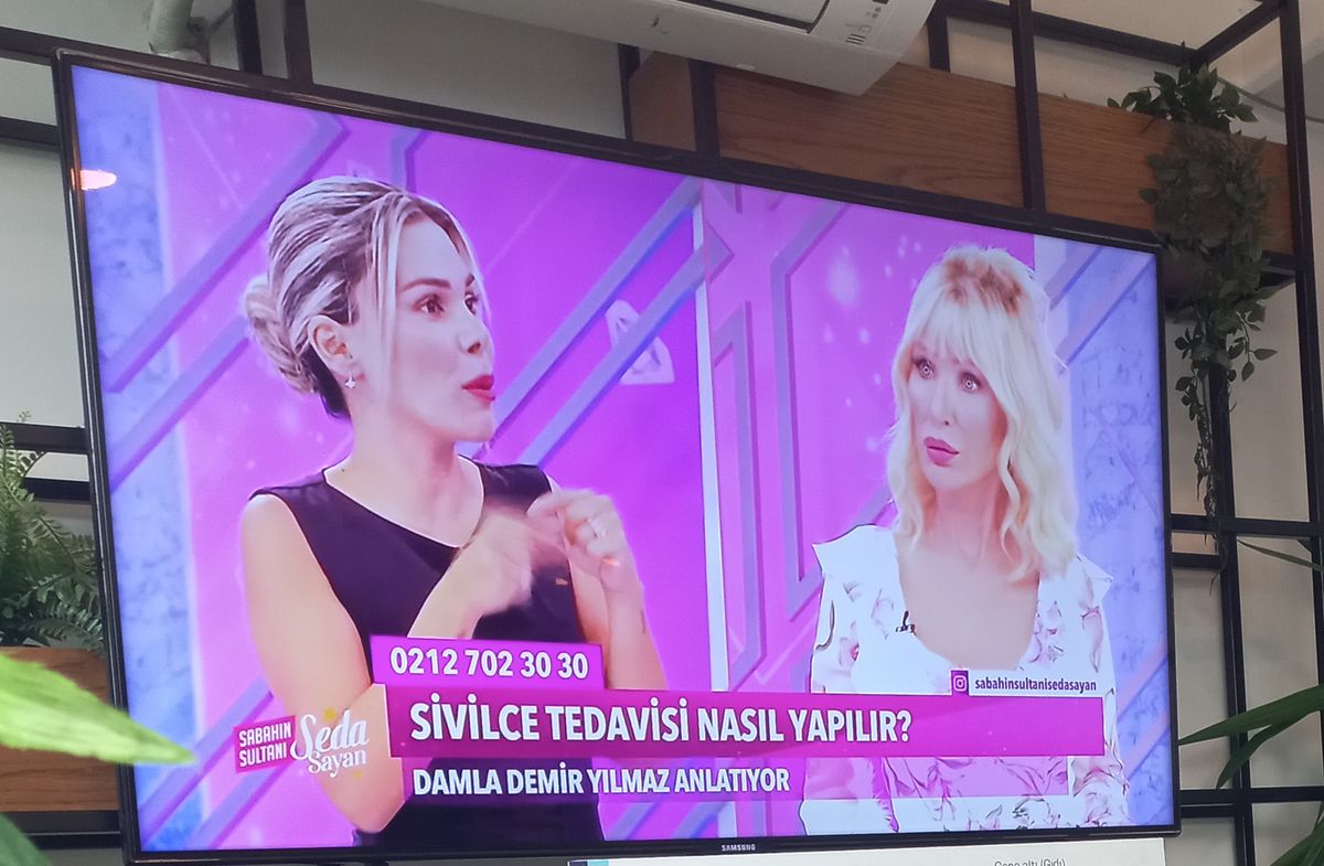 Gönderi görseli