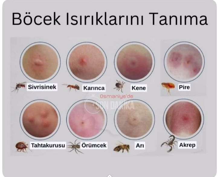 Gönderi görseli