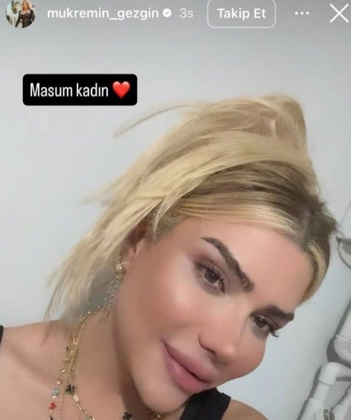 Gönderi görseli