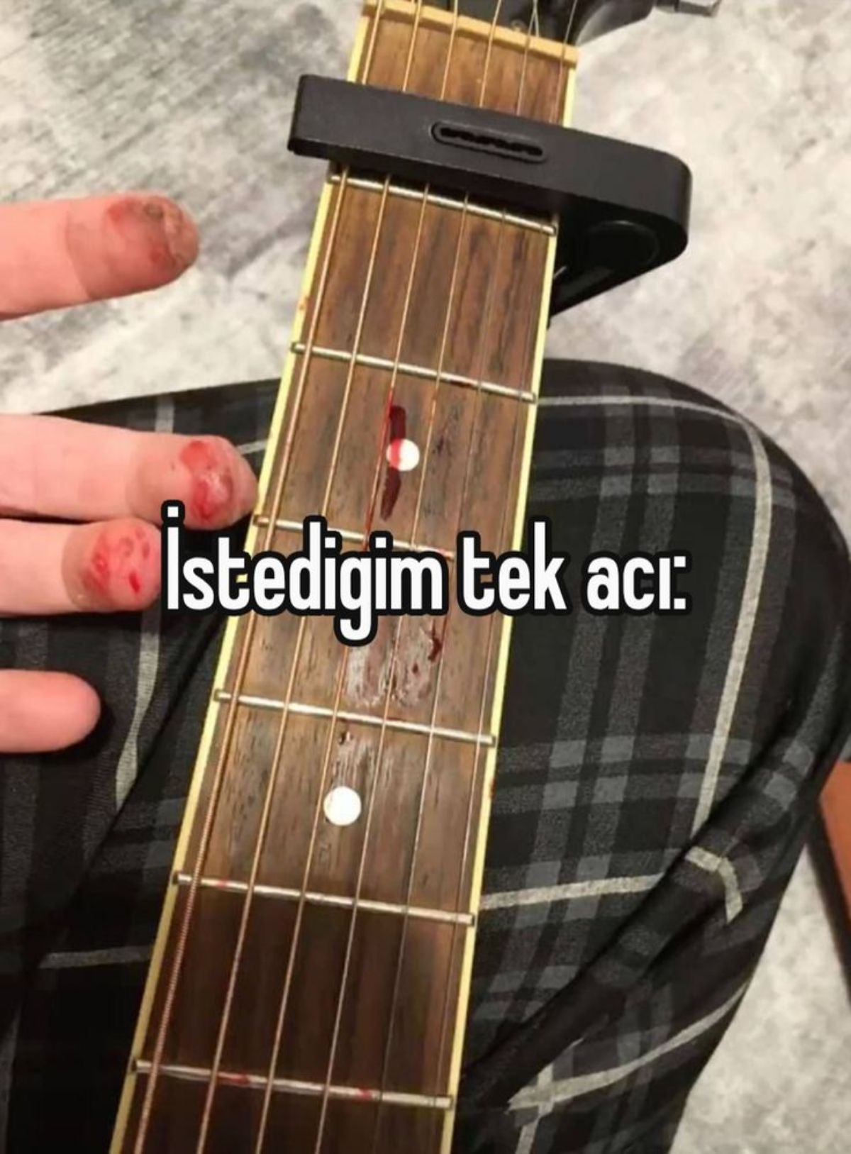 Gönderi görseli